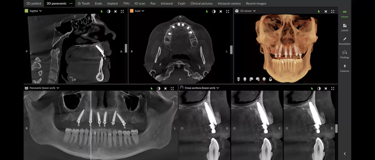 DEXIS Dental Imaging bei Held Dentalgeräte | Effizienz & Präzision